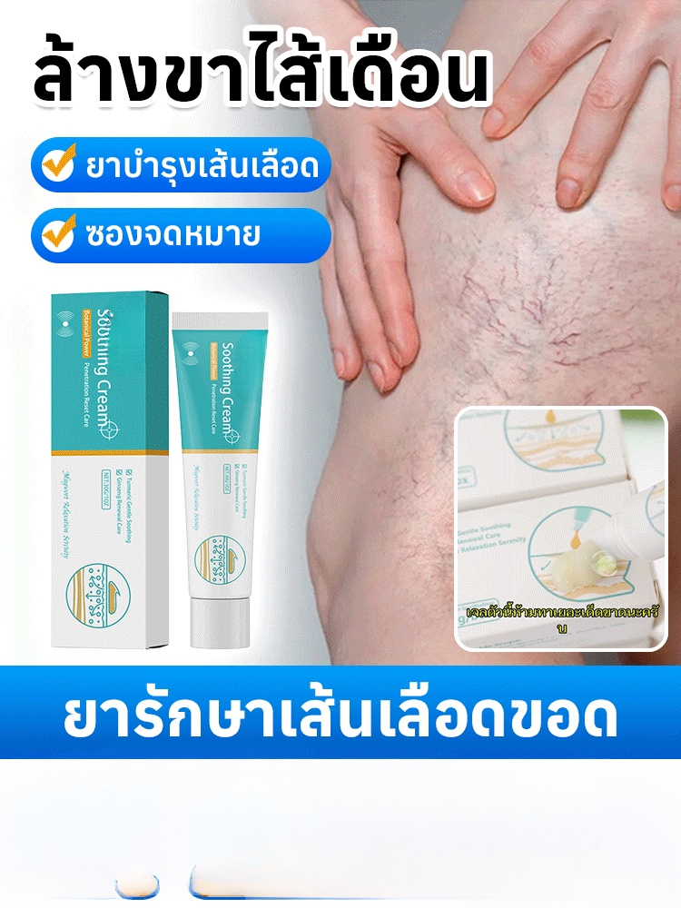 【รักษาเฉพาะเส้นเลือดขอด】เจลขอด