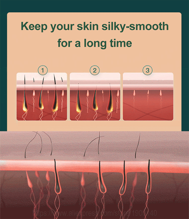 Home Laser Hair Removal