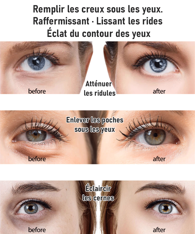 Jaysuing Crème Contour des Yeux Active