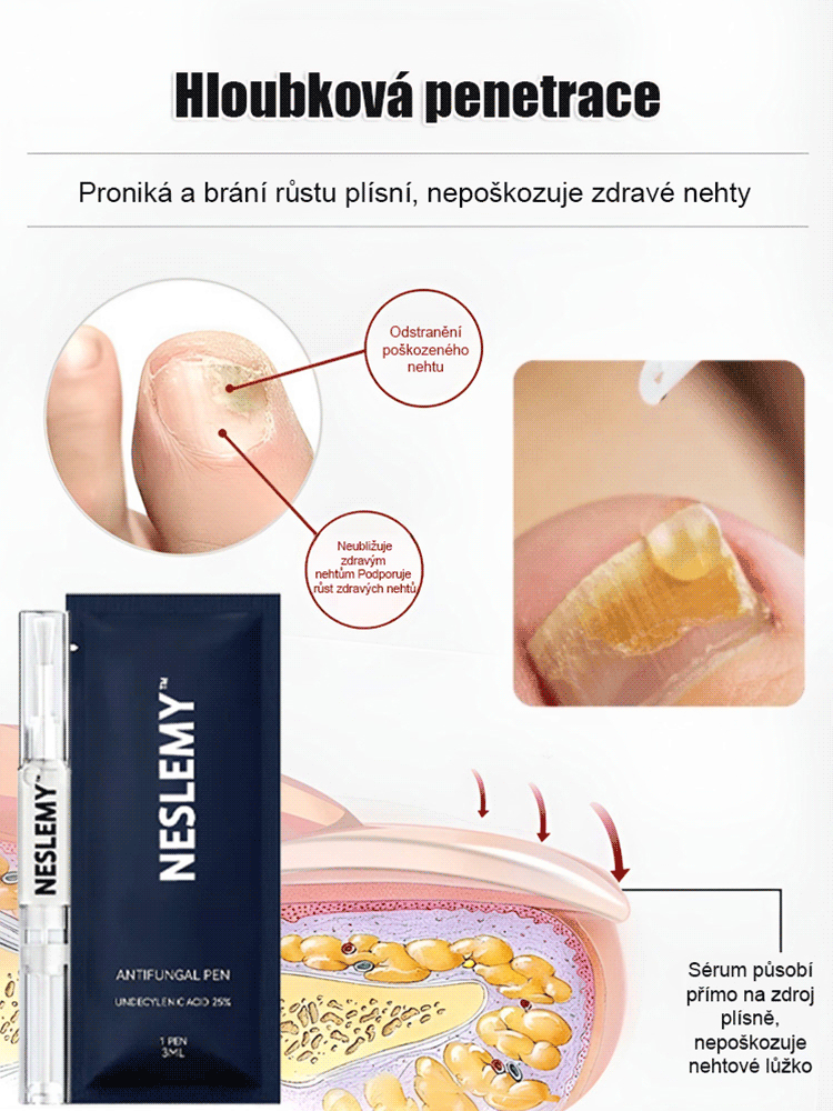 Silná antimykotická tužka na opravu nehtů