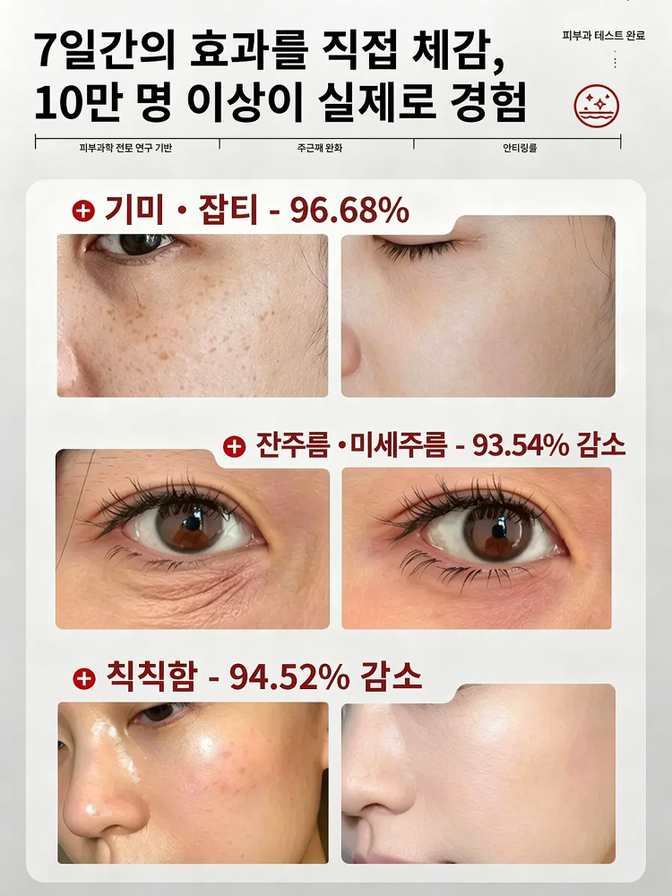 【7일 만에 완고한 잡티 제거】천연 성분 기미 크림