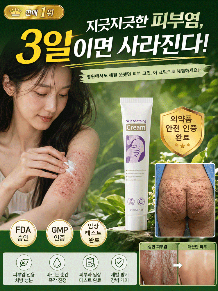 【피부염 집중 케어】피부 진정 케어 크림