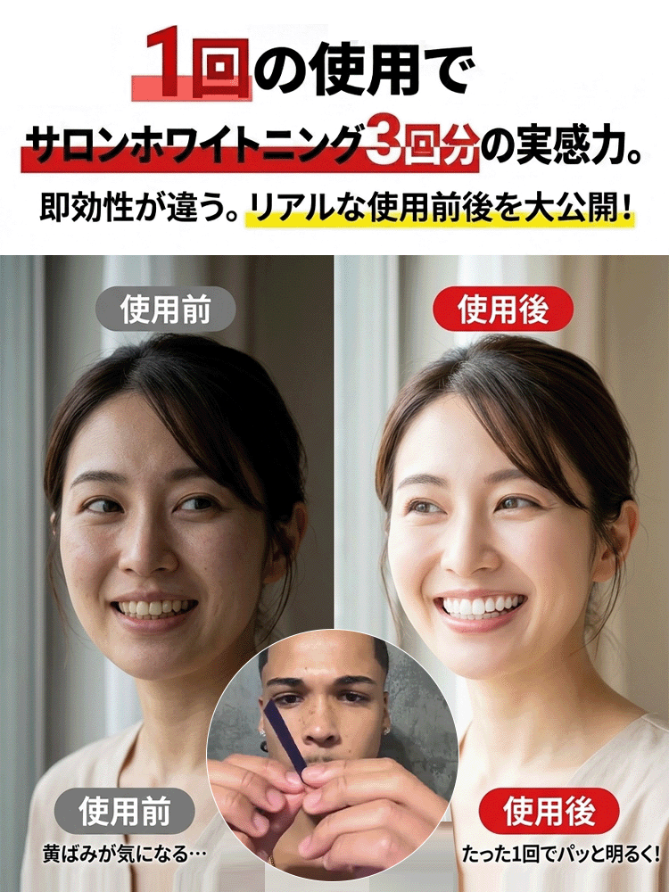 ホワイトニングシート