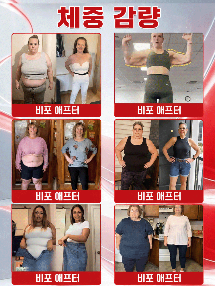 [7일 만에 내장지방 녹이는] 10in1 나노 미세침 뱃살 멜팅패치