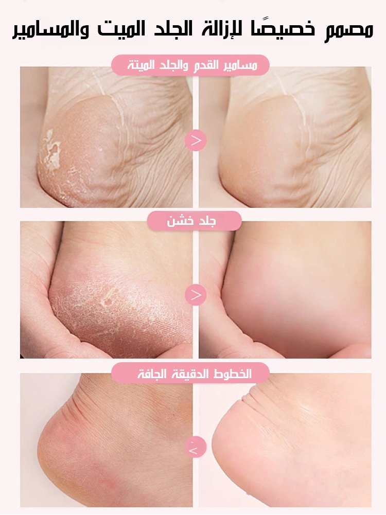 【صنع في ألمانيا】 مبرد القدم الكهربائي لإزالة الجلد الميت