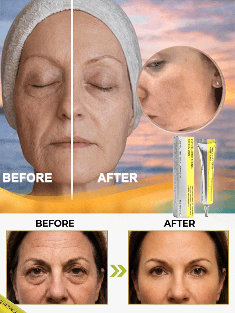 Retinol Firming & Lifting Eye Cream