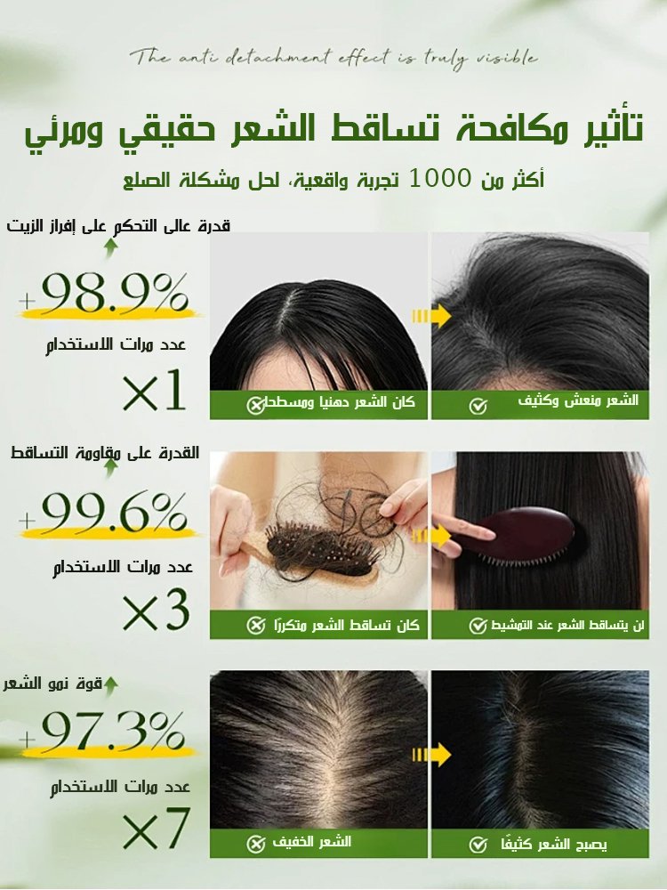 شامبو إكليل الجبل والأحماض الأمينية لمنع تساقط الشعر (فعّال في منع التساقط)