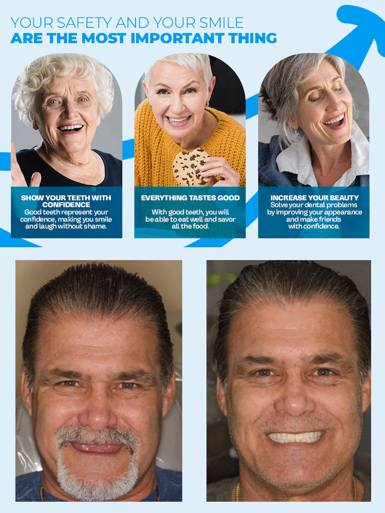 [Professional Quality] Adaptive Full Coverage Denture