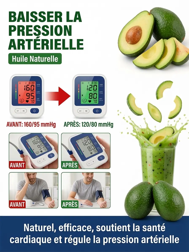 Avocatier Hass "Récolte Express" : Le Seul Arbre qui Résiste à -38°C