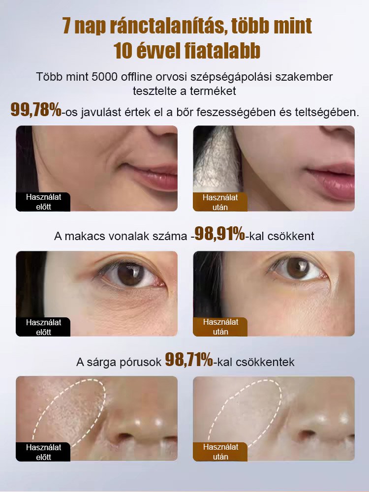 【Ránctalanító NO.1】Arany hexapeptid feszesítő esszencia