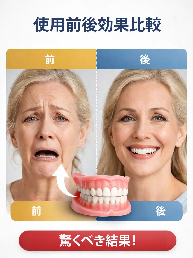 カスタムフィットマウスピース