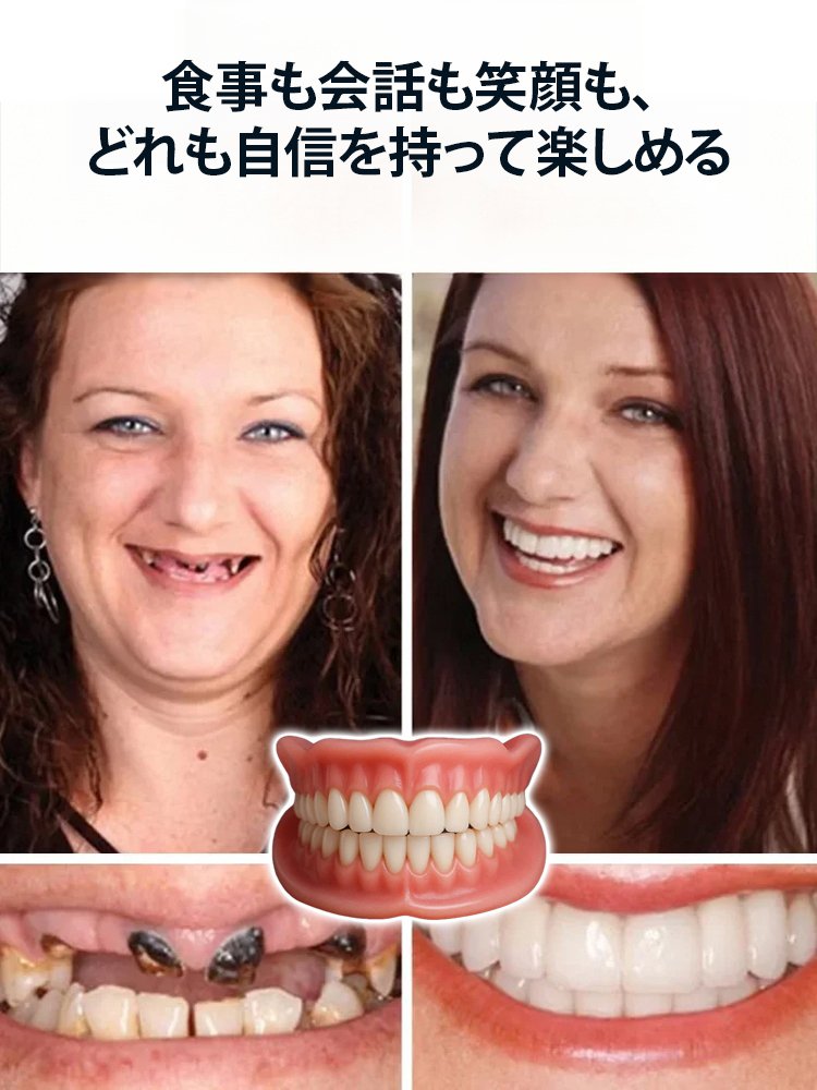 カスタムフィットマウスピース