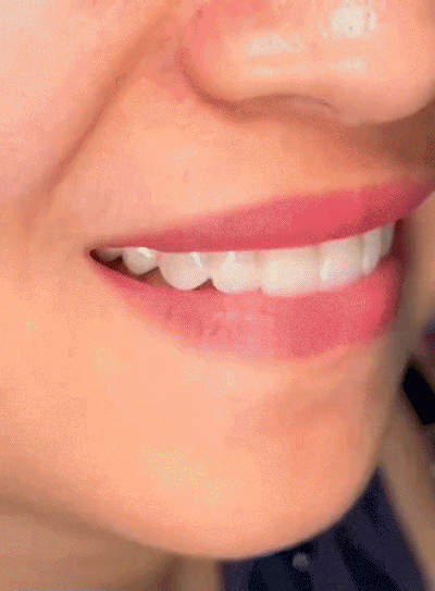 1.gif