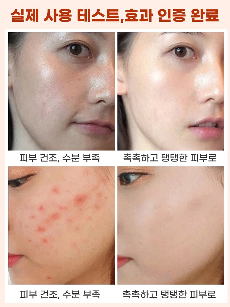 영양 건강 빨간 배추씨