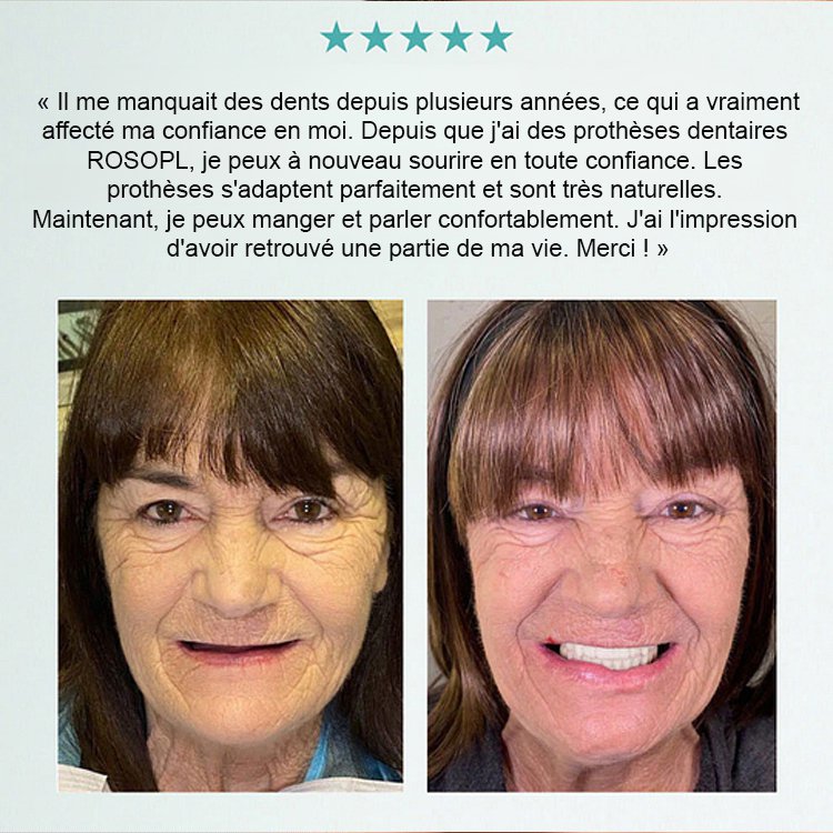 【Tout compris sur mesure】Kit de soin et de retouche pour prothèses dentaires