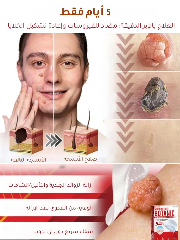 لصقات العناية بالبشرة لإزالة الثآليل من الوجه والجسم