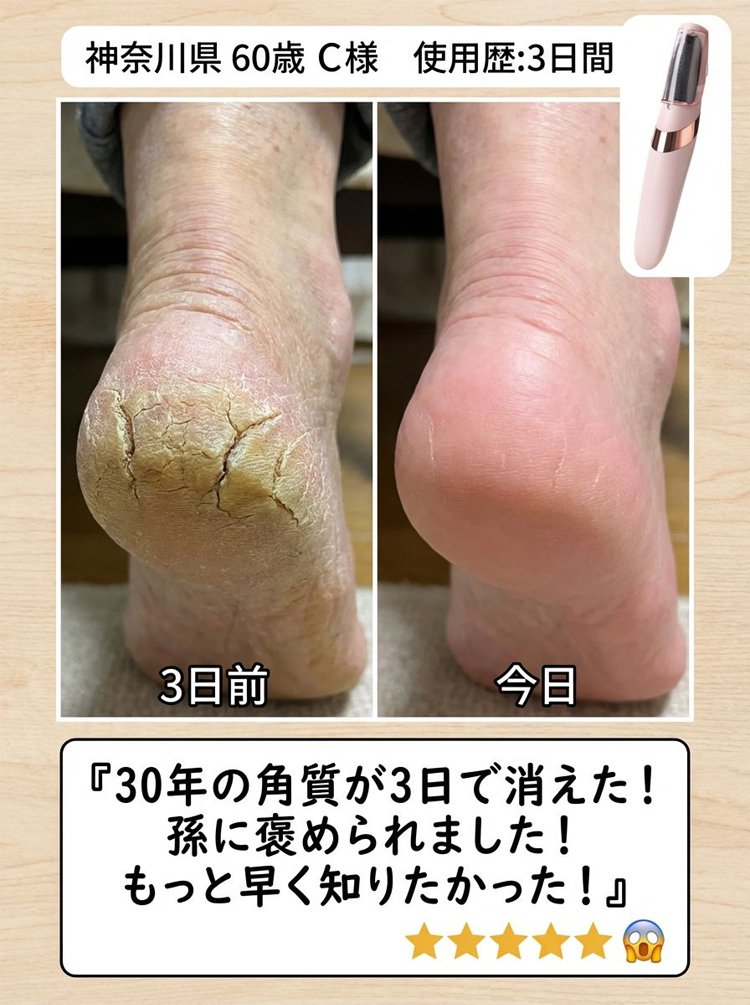 磨脚器_26.jpg