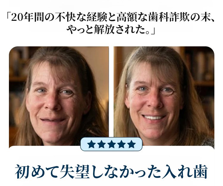 翻译件-HFH-自然贴合全包美容假牙套-1338742_10.jpg
