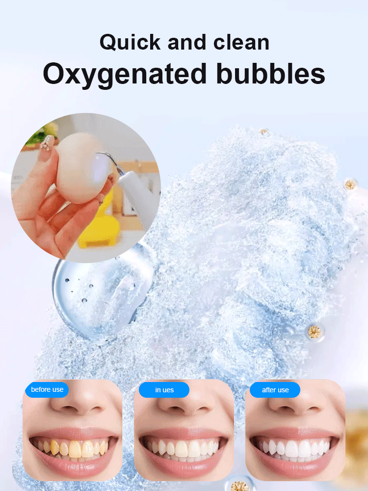Ultraviolet sterilization ultrasonic toothbrush