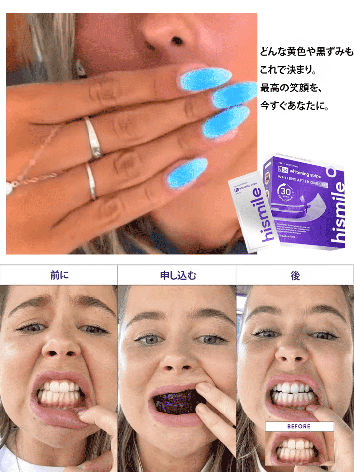 たった一枚で、白く輝く自信の笑顔へ。 歯の黄ばみをケアする美白ホワイトニングパッチ。