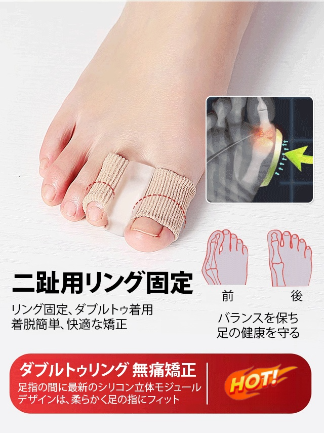 【最新モデル】外反母趾サポーター