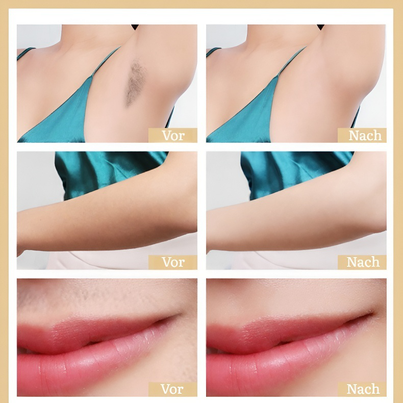 Epilierer Salonqualität HIPL Licht Heimgebrauch Epilierer VIO Korrespondenz Schmerzlose Saphirkühlun