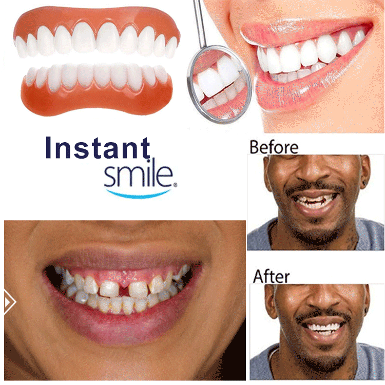 『インスタントスマイル』instant smile四代目  着脱可能な美白付け歯  素敵な笑顏を取り戻します！