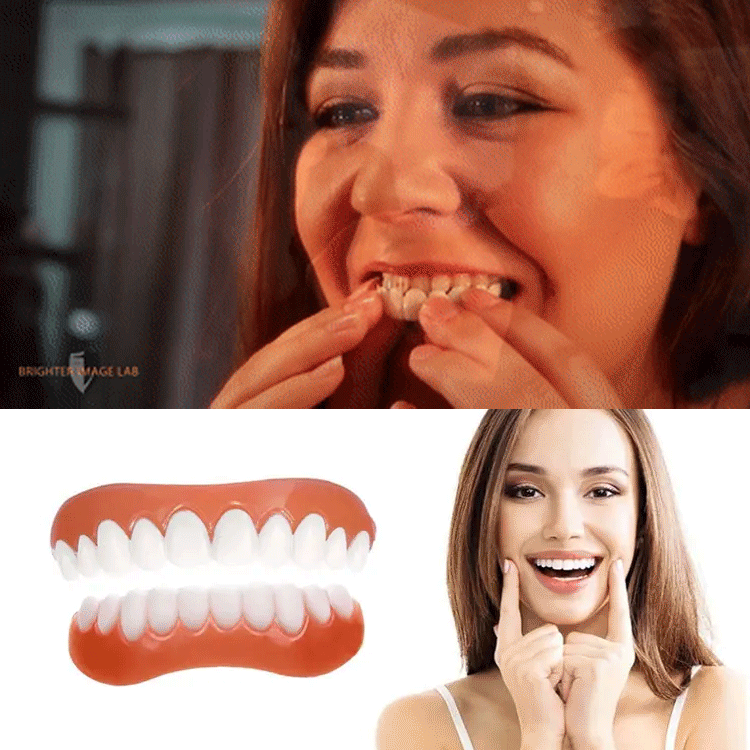 『インスタントスマイル』instant smile四代目  着脱可能な美白付け歯  素敵な笑顏を取り戻します！