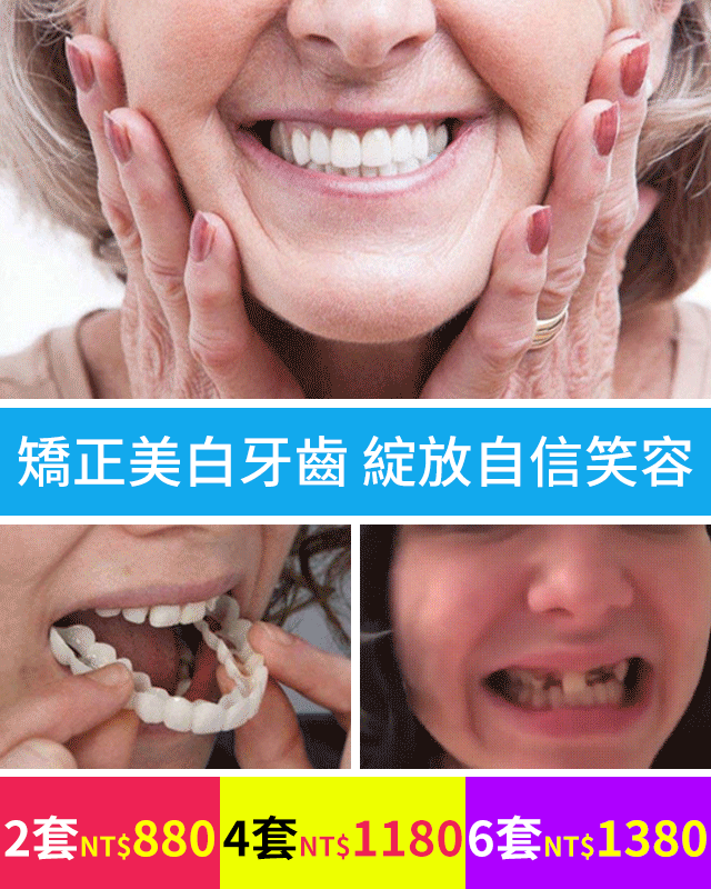 【隱形 美白 矯正】snaponsmile第三代牙套套裝