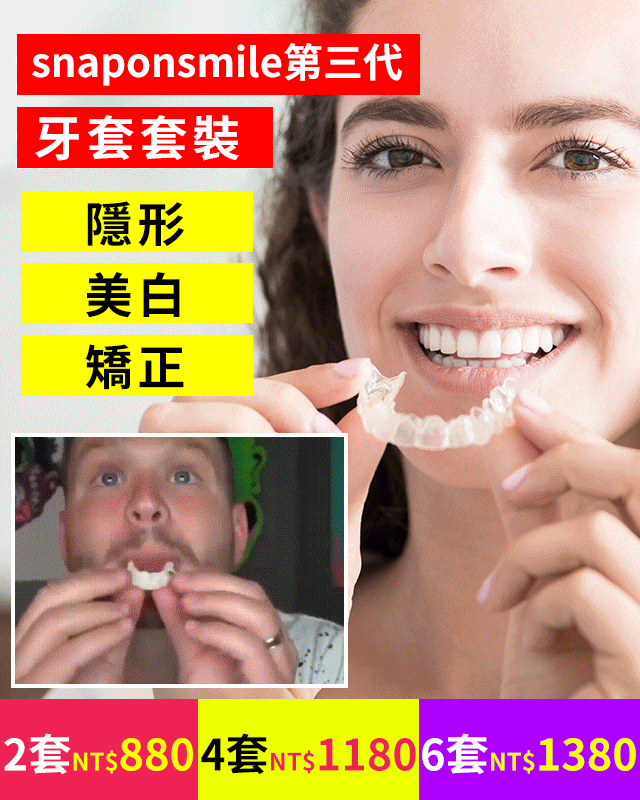 【隱形 美白 矯正】snaponsmile第三代牙套套裝