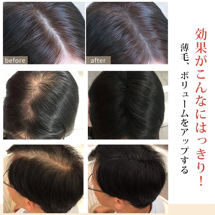 【生え際パウダー】3色展開、キメ細かい粉質、肌に馴染む、自然な仕上がり、防水、１本多役