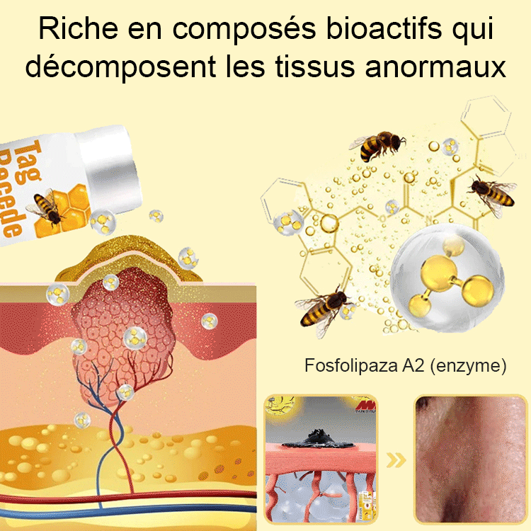 BOOMOON Spray de soin pour verrues au venin d'abeille