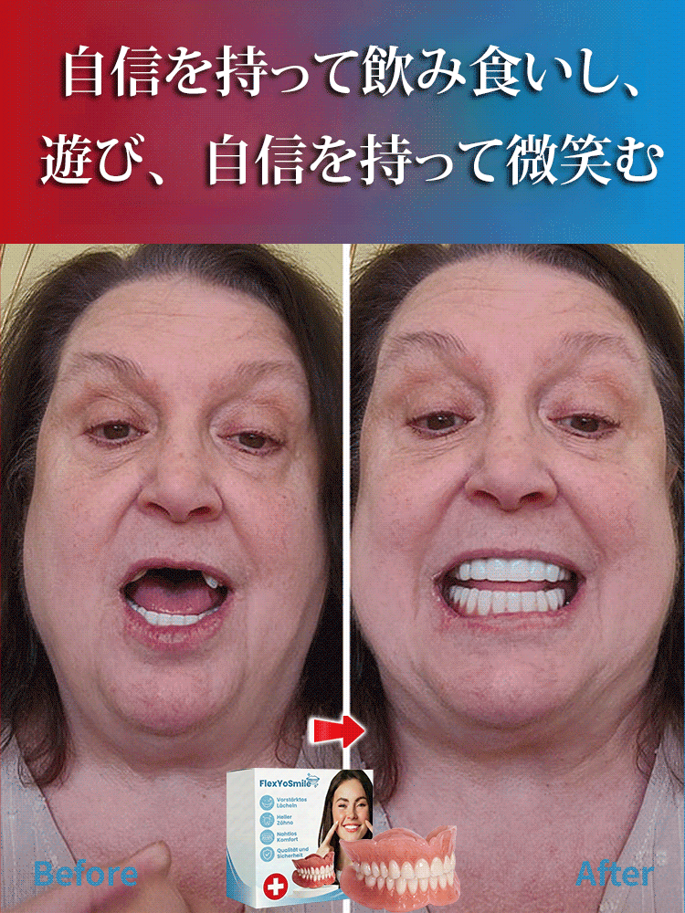 審美用マウスピース，スイス輸入品、口いっぱいのスイス製、そして高貴な身分の象徴！！