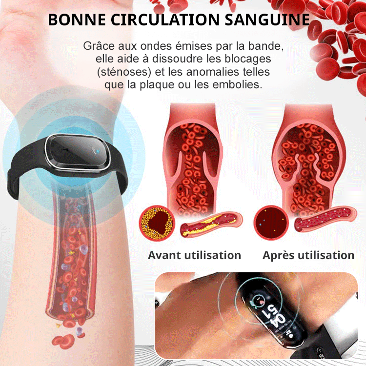 Bracelet électronique minceur à ultrasons