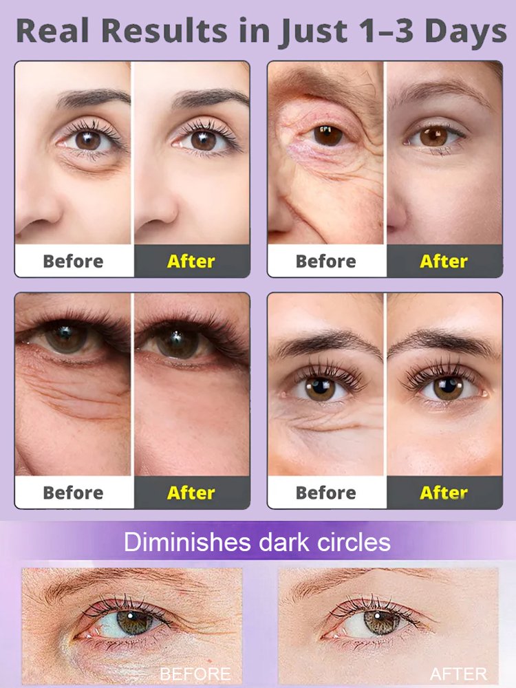 Calcium Factor Brightening and Anti-Aging Eye Cream