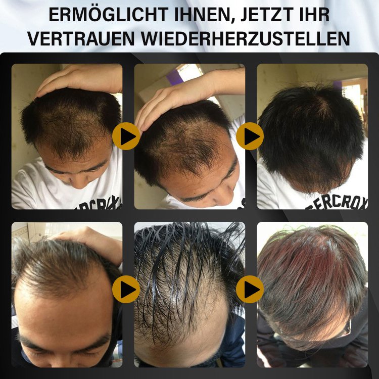 FEG Haarwachstumsspray