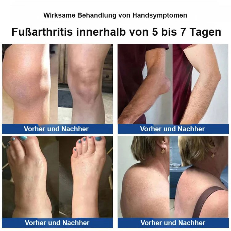 Bienengift-Gelenkpflegesalbe