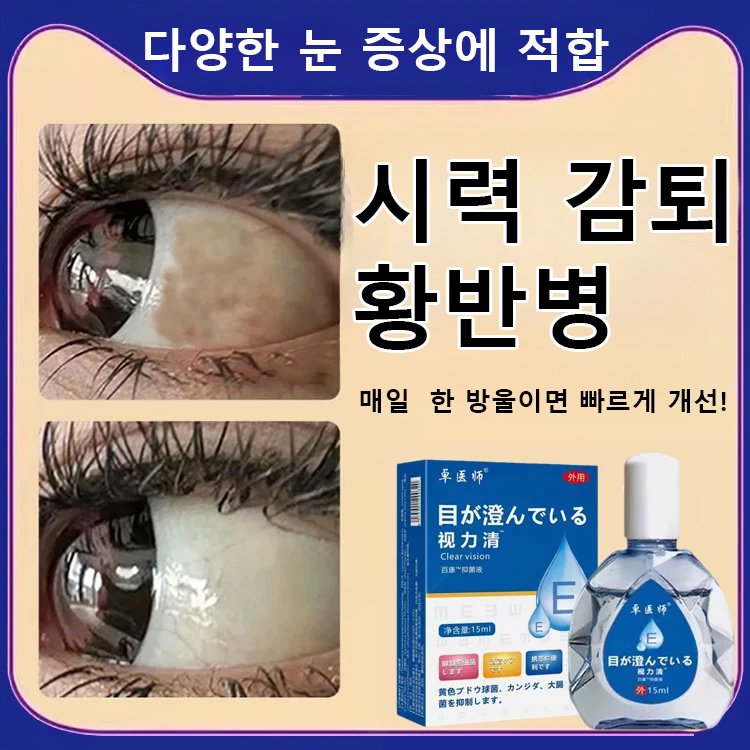 시력 교정 안약