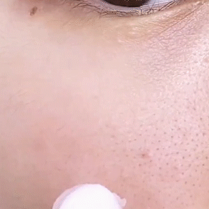 Pórus alsó gél krém