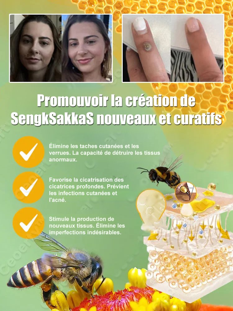 Solution pour éliminer les verrues corporelles