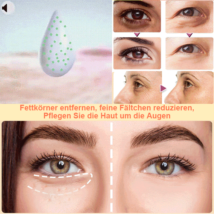 Fettkorn-Augenessenz