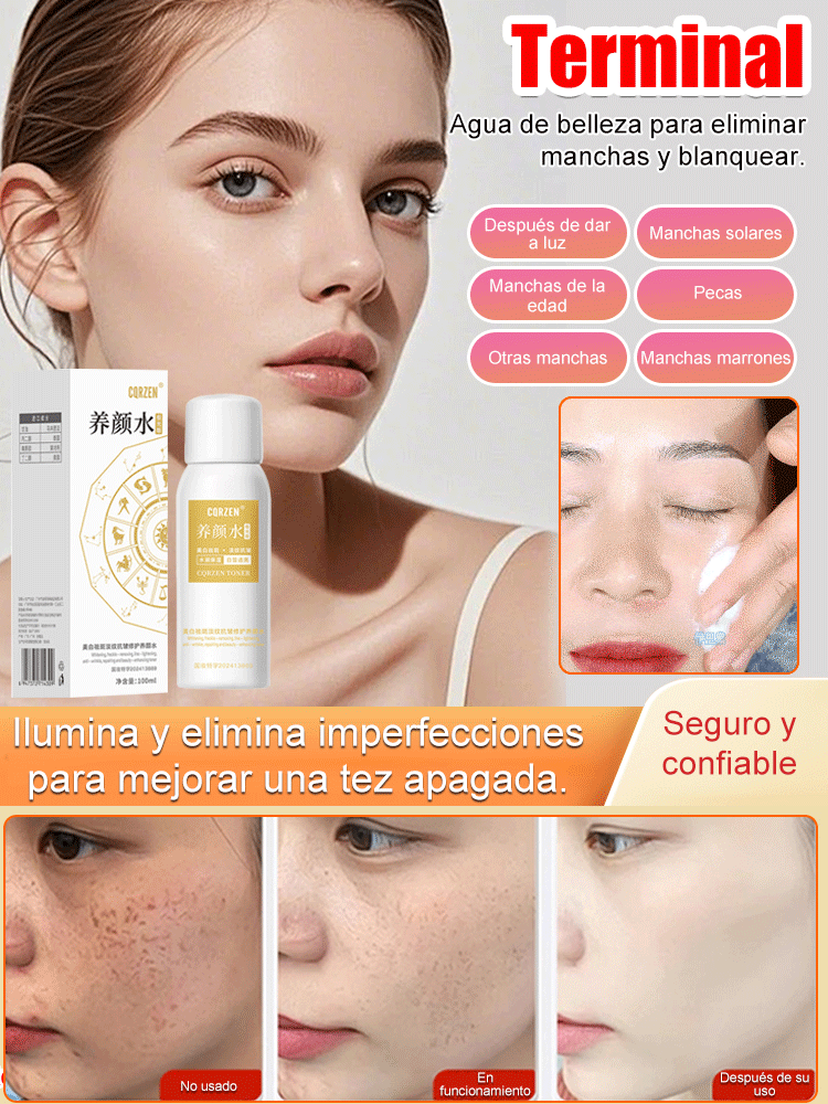 【Spray para eliminar todo tipo de manchas】Spray blanqueador y removedor de manchas