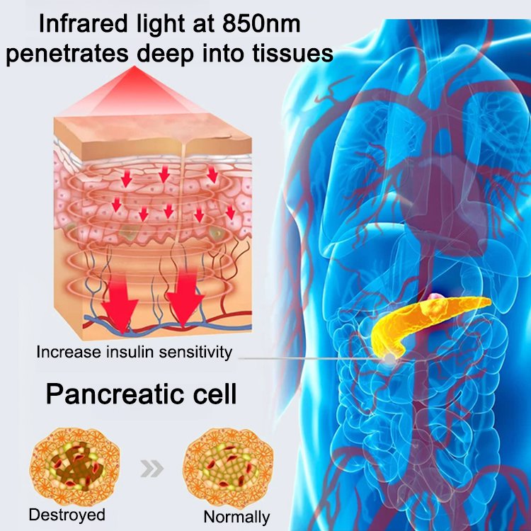 Ultrasonic blood sugar balance bracelet