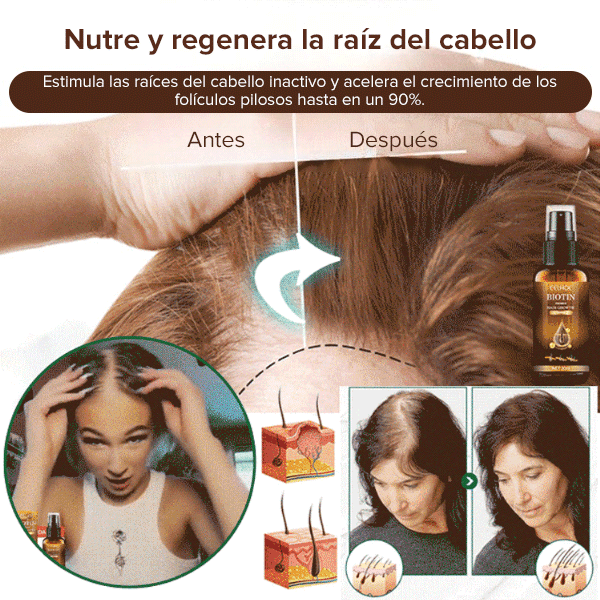 Spray para el crecimiento del cabello con biotina EELHOE