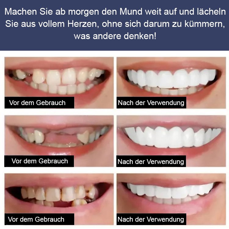 Zahnaufhellung Simulation falsche Zahnspangen