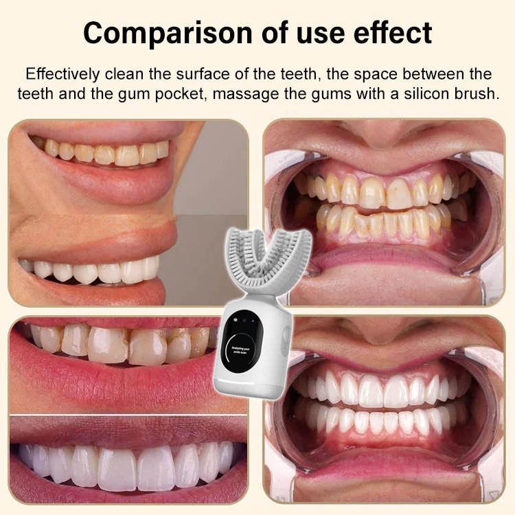 [Dentist development] 10-second fully automatic lazy U-shaped electric toothbrush