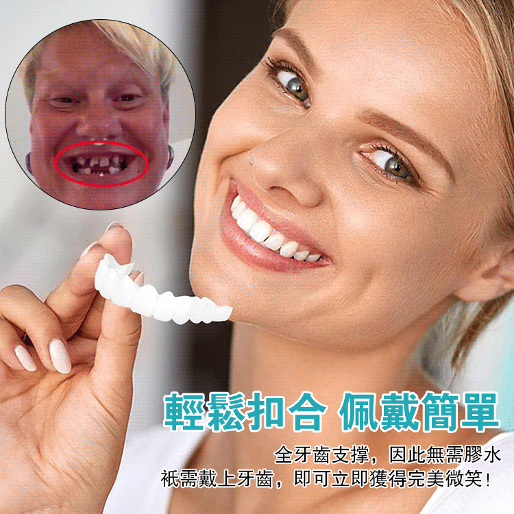 可調節卡扣式假牙