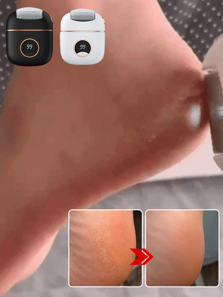 [Remove dead skin in seconds] Electric digital display foot grinder