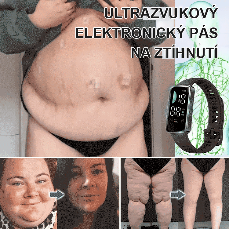 Ultrazvukový elektronický náramek na hubnutí