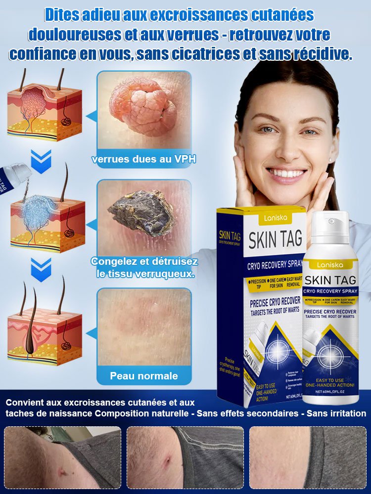 LANISKA spray de soin topique pour points de verrues